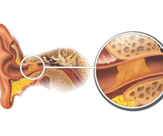 comment nettoyer oreille